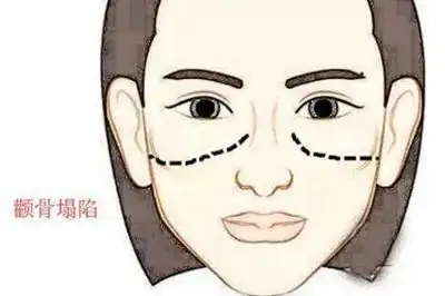 什么面相的女人性格不好又爱抱怨呢

